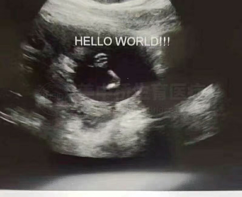 泰国试管婴儿